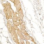 Dystrophin Polyclonal Antibody