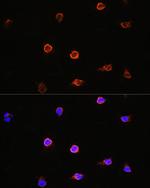 AIPL1 Polyclonal Antibody