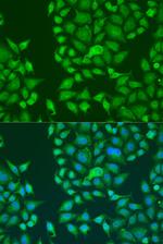 STAU2 Antibody in Immunocytochemistry (ICC/IF)