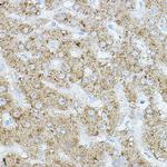 HRI Polyclonal Antibody