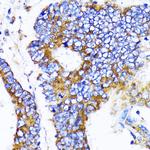 MRPL13 Antibody in Immunohistochemistry (Paraffin) (IHC (P))