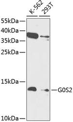 G0S2 Antibody in Western Blot (WB)