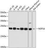 NOP16 Antibody in Western Blot (WB)