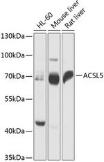 ACSL5 Polyclonal Antibody