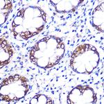 SLC6A4 Polyclonal Antibody