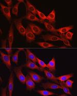 Vinculin Polyclonal Antibody