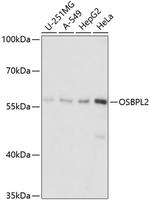 ORP2 Polyclonal Antibody
