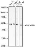 AGTR1 Polyclonal Antibody