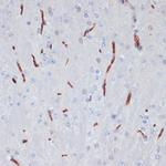 ApoA1 Polyclonal Antibody