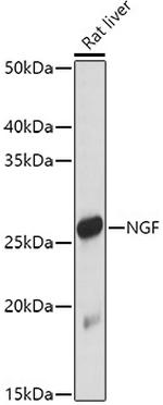 NGF Polyclonal Antibody