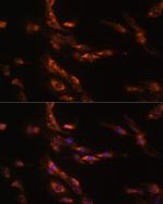 GABRG1 Polyclonal Antibody