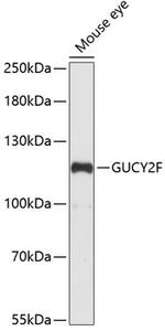 PGCF Polyclonal Antibody