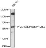 PPP2R5B Polyclonal Antibody