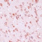 RPL21 Antibody in Immunohistochemistry (Paraffin) (IHC (P))