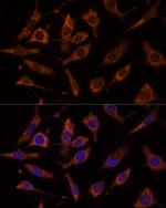RPL24 Polyclonal Antibody