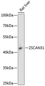 ZNF323 Antibody in Western Blot (WB)