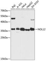 Nop25 Polyclonal Antibody