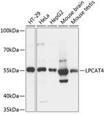 LPCAT4 Antibody in Western Blot (WB)