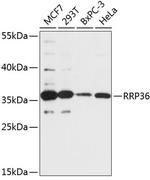RRP36 Polyclonal Antibody