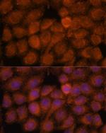 NDUFAF4 Antibody in Immunocytochemistry (ICC/IF)
