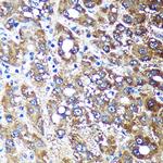 NDUFAF4 Antibody in Immunohistochemistry (Paraffin) (IHC (P))
