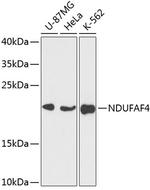 NDUFAF4 Antibody in Western Blot (WB)
