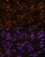 PREPL Antibody in Immunocytochemistry (ICC/IF)