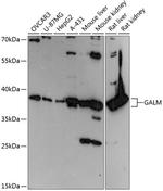 GALM Polyclonal Antibody