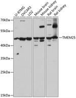 TMEM25 Antibody in Western Blot (WB)