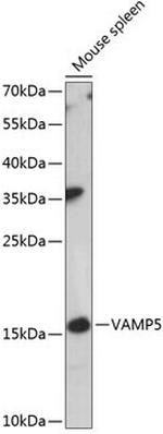 VAMP5 Antibody in Western Blot (WB)