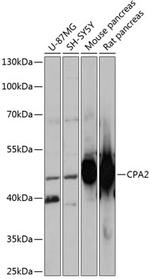 Carboxypeptidase A2 Antibody in Western Blot (WB)
