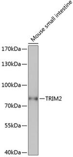 TRIM2 Polyclonal Antibody