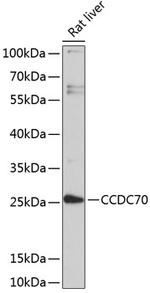 CCDC70 Antibody in Western Blot (WB)