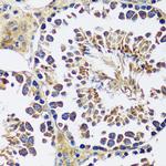 CCDC124 Antibody in Immunohistochemistry (Paraffin) (IHC (P))