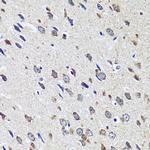 CCDC124 Antibody in Immunohistochemistry (Paraffin) (IHC (P))