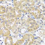 CCDC124 Polyclonal Antibody