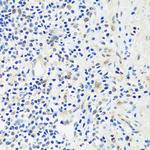 ASCL4 Antibody in Immunohistochemistry (Paraffin) (IHC (P))