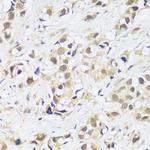 ASCL4 Antibody in Immunohistochemistry (Paraffin) (IHC (P))