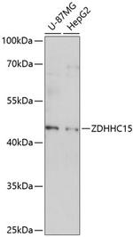 ZDHHC15 Polyclonal Antibody
