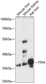 alpha TTP Polyclonal Antibody