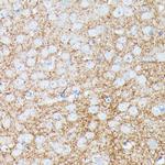 gamma Synuclein Polyclonal Antibody