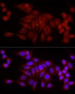 SNRPD1 Antibody in Immunocytochemistry (ICC/IF)
