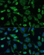 SPARC Antibody in Immunocytochemistry (ICC/IF)