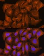 Nicastrin Polyclonal Antibody