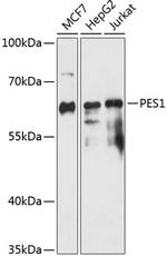 PES1 Polyclonal Antibody