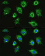 ZAK Polyclonal Antibody