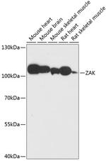 ZAK Antibody in Western Blot (WB)