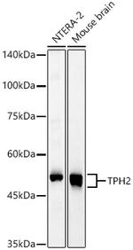 TPH2 Polyclonal Antibody
