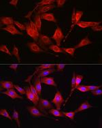 GSS Antibody in Immunocytochemistry (ICC/IF)