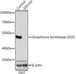 GSS Antibody in Western Blot (WB)